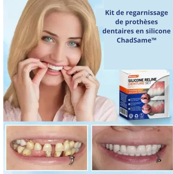 Kit de regarnissage de prothèses dentaires en silicone